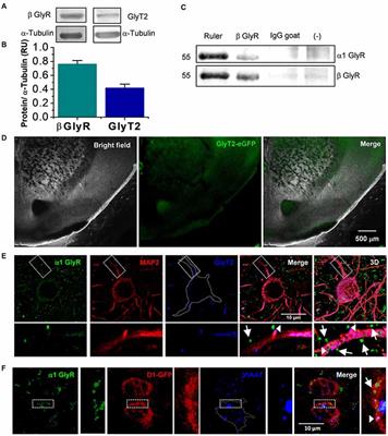 Presence of Inhibitory Glycinergic Transmission in Medium Spiny Neurons in the Nucleus Accumbens